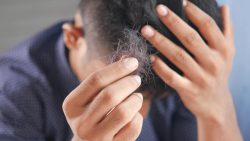 تفسير حلم البكاء على تساقط الشعر في المنام